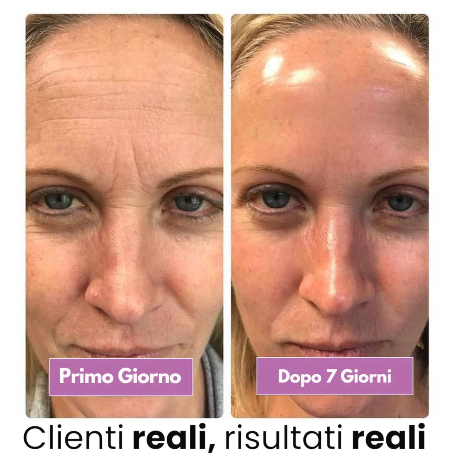 Crema al collagene coreana